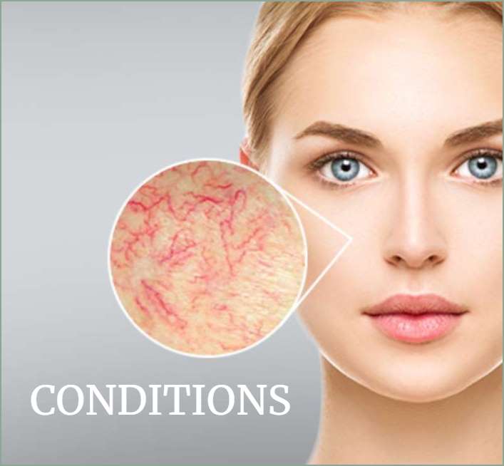 Body and Face Condition Treatments in Carlisle, Cumbria
